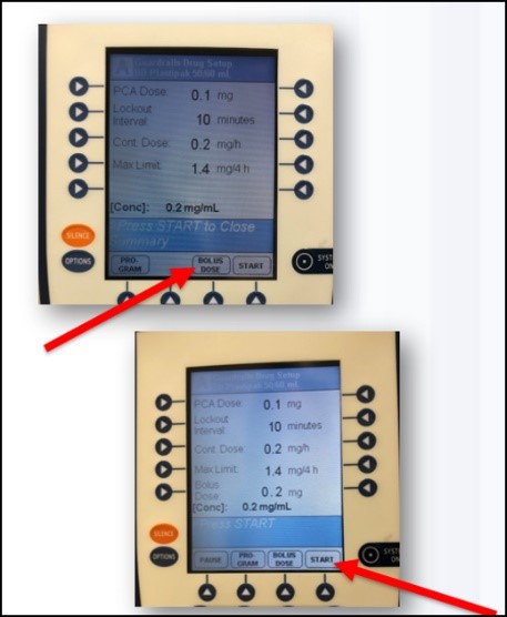 Patient-Controlled Analgesia Pumps