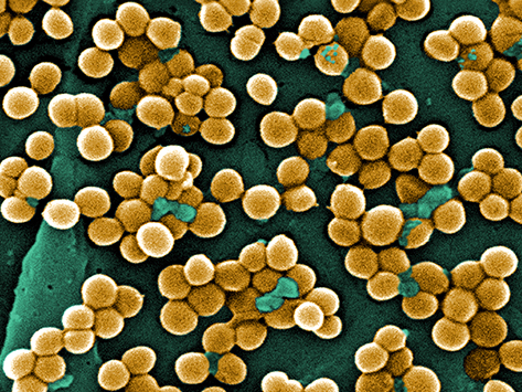 Methicillin-resistant Staphylococcus aureus, or MRSA.
