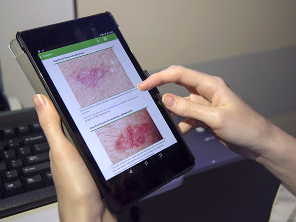 Pearson uses UpToDate's mobile app to find information on basal cell carcinoma, the most frequently occurring form of skin cancer.