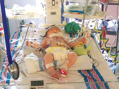 Cayson Sanderford is shown in 2011 after surgery at Batson Children's Hospital.