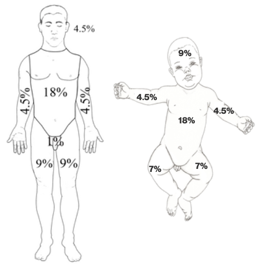An illustration of two people: one adult, one child, showing the percentage of the total body surface area for each section of the body.