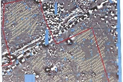 The Asylum Hill Project is exhuming thousands of unmarked graves on UMMC's main campus in Jackson.