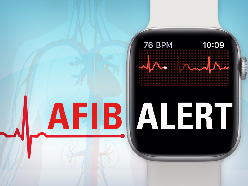 Smartwatch warning: AFib tests yield 'high rate' of false positives on  wearable tech with ECG strips