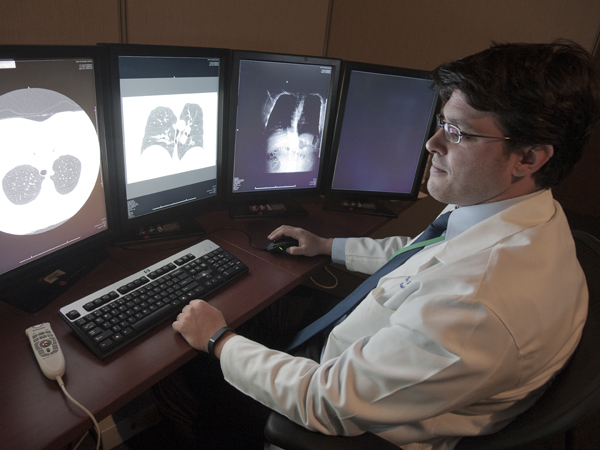 Low-dose CT screen better pinpoints lung cancer