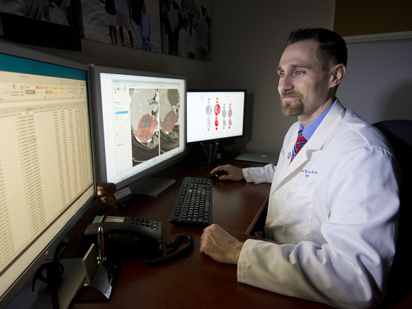 UMMC researcher: CT texture may improve melanoma survival predictions