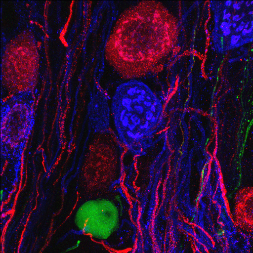 Spinal blood vessels (blue) are surrounded by cells that maintain the blood-spinal cord barrier (green) and help restore myelin after trauma (red).