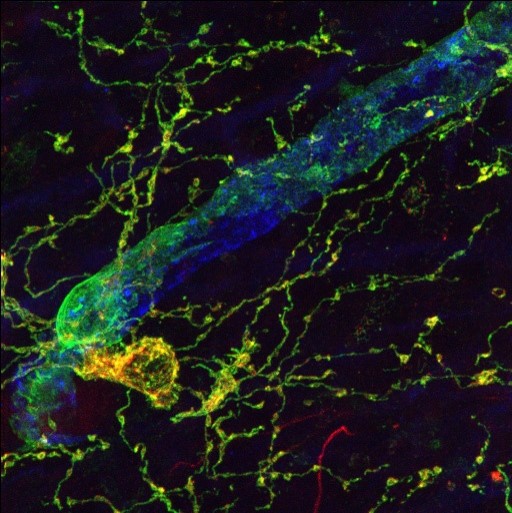 The thoracic dorsal root ganglion (a cluster of nerve cells in the spinal cord) is the first area where neuropathic pain occurs after SCI. Different types of neurons sensitive to pain can be seen using specific markers (red, green and blue).