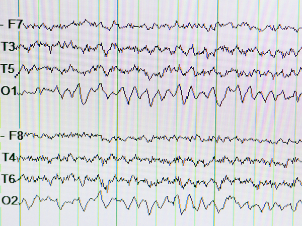 Electrical activity in the brain is measured with EEGs.