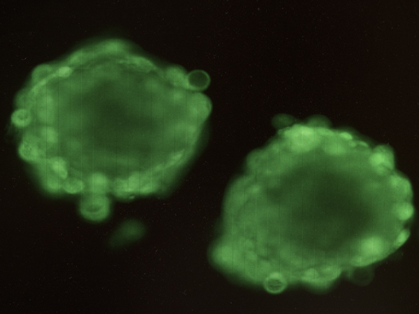 The 3-D adipose model under magnification. Charged polyelectrolytes and elastin-like polypeptide force fat cells together, forming spheroid rather than flat cell cultures.
