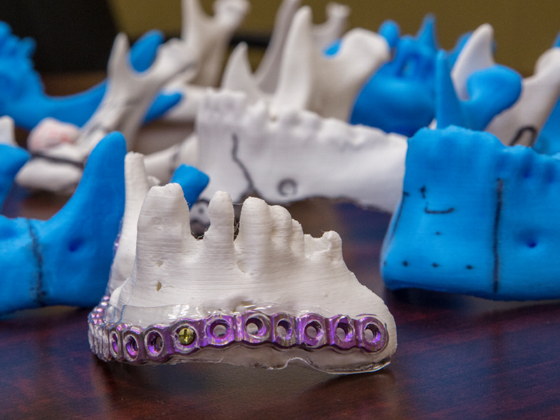 3D printed models save time, money in operating room