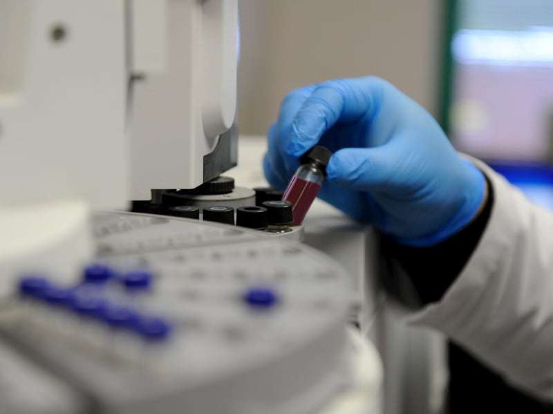 UMMC has started a new clinical trial to test whether antibodies in blood plasma from people who have recovered from COVID-19 can help treat patients still dealing with severe forms of the disease. Photo copyright Getty Images.