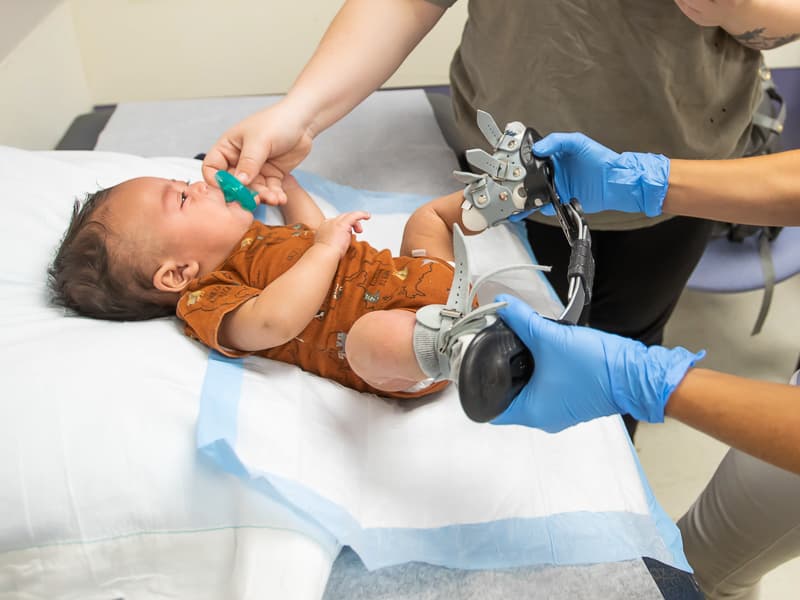 Children’s of Mississippi treatment for clubfoot starts before birth