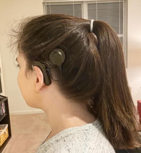 Lauren Langan models her cochlear implant days after activation